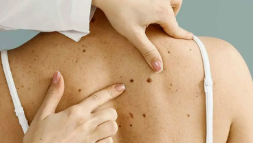 Estetika Epidermis: Mencapai Hasil Akhir yang Mulus dan Bebas Gangguan